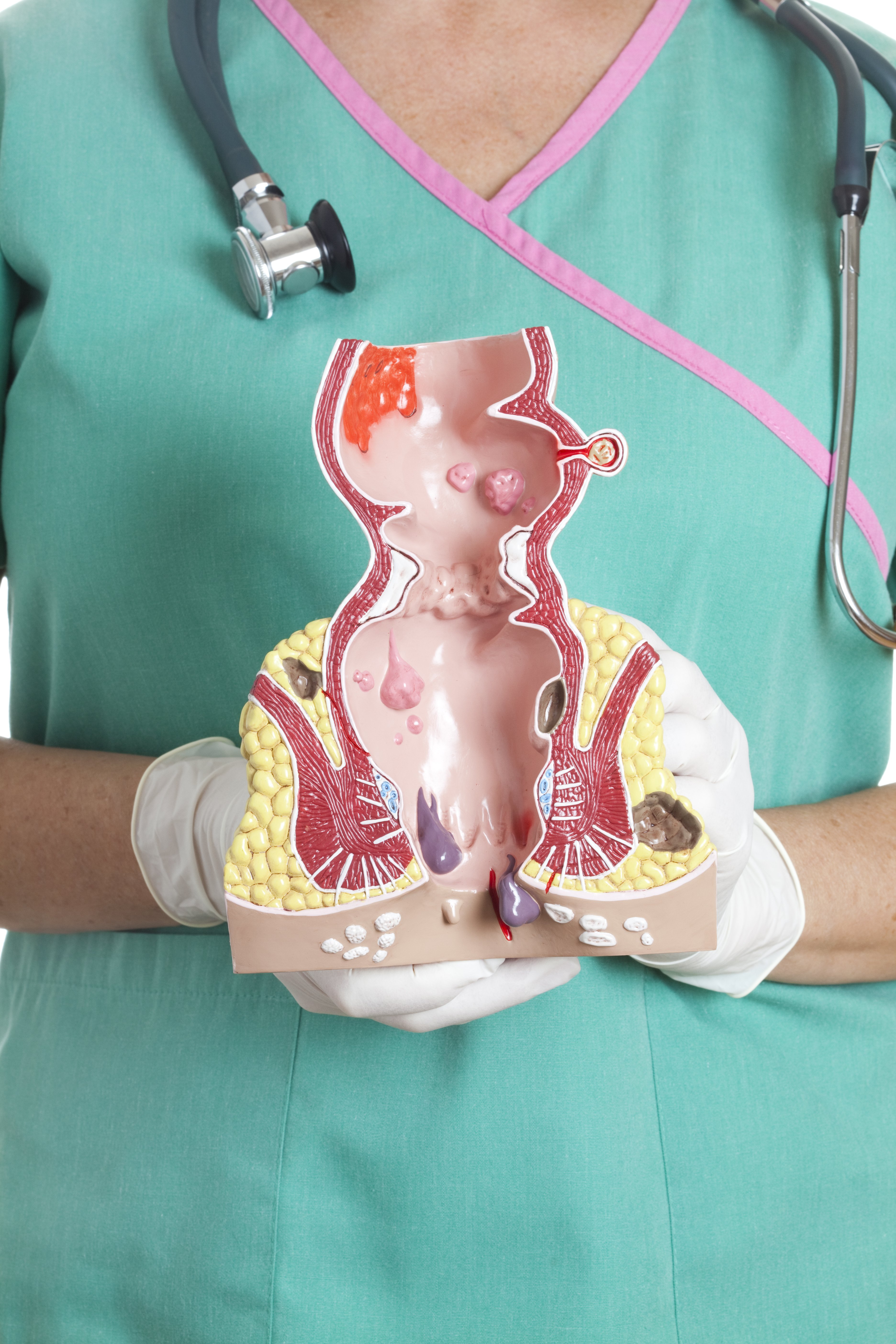 Острое воспаление геморроя. Инфракрасной фотокоагуляции геморроидальных узлов. Геморрой клинические рекомендации. Алоэ и геморрой. Схема терапии геморроя.